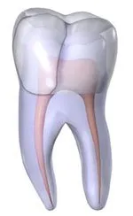 Dr. Jacobson, picture of fractured tooth